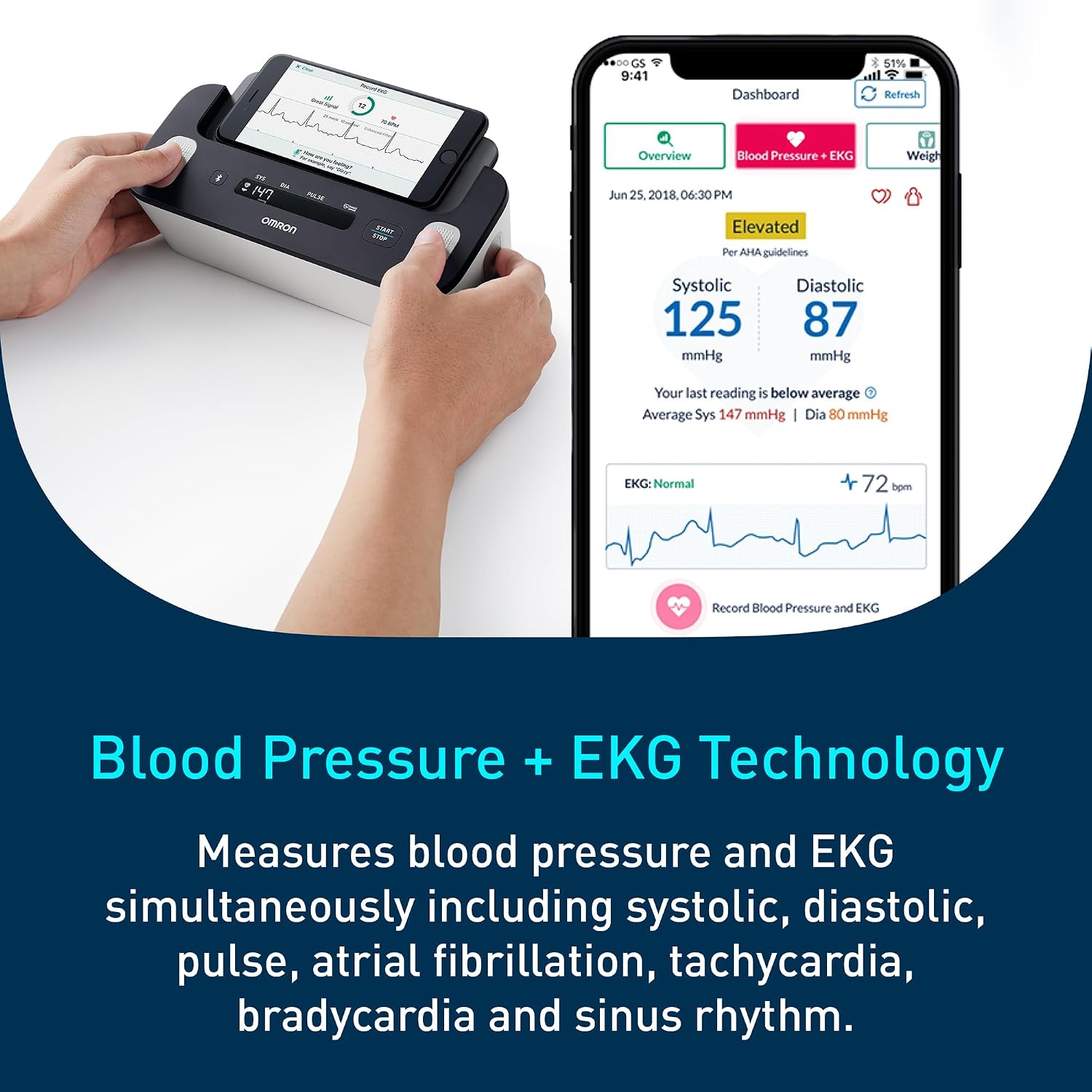 Omron Complete 2-in-1 Blood Pressure Monitor + EKG