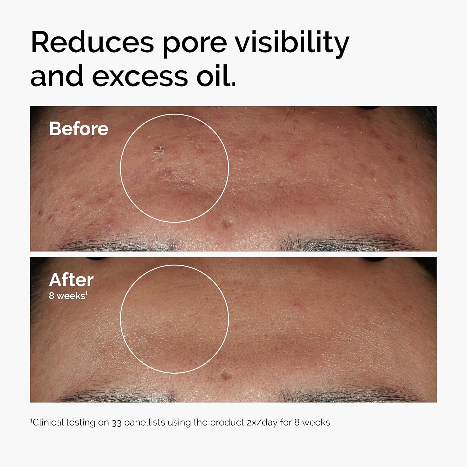 Ordinary The Ordinary Niacinamide 10% + Zinc 1% Face Serum